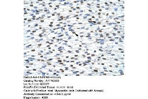 Immunohistochemistry (IHC) image for anti-Heterogeneous Nuclear Ribonucleoprotein A0 (HNRNPA0) (Middle Region) antibody (ABIN2779011)
