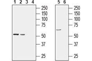 Western blot analysis of rat brain (lanes 1 and 3), mouse brain (lanes 2 and 4), (1:200) and human brain neuroblastoma SH-SY5Y cell line lysates (lanes 5 and 6), (1:600): - 1, 2, 5. (PACSIN1 Antikörper  (Intracellular))