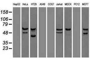 Image no. 6 for anti-Checkpoint Kinase 2 (CHEK2) antibody (ABIN1497498) (CHEK2 Antikörper)