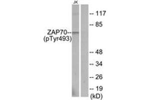 Western blot analysis of extracts from Jurkat cells, using ZAP-70 (Phospho-Tyr493) Antibody.