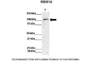 Lanes:   Lane 1: 50ug Hela Lysate  Primary Antibody Dilution:   1:1000  Secondary Antibody:   Anti-rabbit-HRP  Secondary Antibody Dilution:   1:10,000  Gene Name:   RBM14  Submitted by:   Archa Fox, University of Western Australia (RBM14 Antikörper  (N-Term))