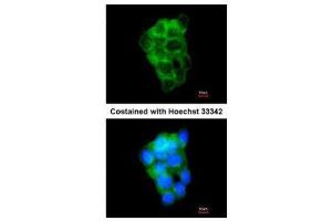 ICC/IF Image Immunofluorescence analysis of methanol-fixed A431, using PPFIBP2, antibody at 1:200 dilution. (PPFIBP2 Antikörper  (Center))