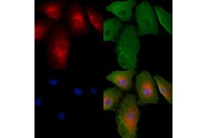 ABIN6264924 and ABIN6279466 staining  cells by IF/ICC. (SAR1A Antikörper  (Internal Region))