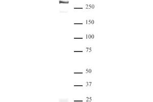 Western blot of ATRX antibody. (ATRX Antikörper  (C-Term))