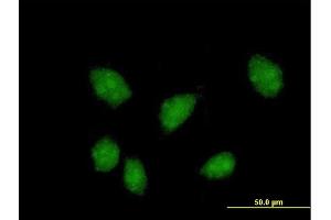 Immunofluorescence of purified MaxPab antibody to FKBPL on HeLa cell. (FKBPL Antikörper  (AA 1-349))