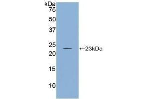 Detection of Recombinant RGS4, Human using Polyclonal Antibody to Regulator Of G Protein Signaling 4 (RGS4) (RGS4 Antikörper  (AA 38-205))