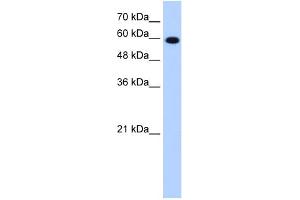 WB Suggested Anti-STIP1 Antibody Titration:  1. (STIP1 Antikörper  (C-Term))