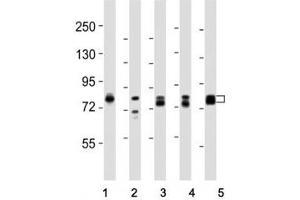 Western blot testing of DNM1L antibody at 1:8000 dilution and lysate from: 1: rat PC12; 2: human skeletal muscle; 3: HeLa; 4: mouse NIH3T3; 5: LNCaP; Predicted molecular weight is 82 kDa. (Dynamin 1-Like Antikörper  (C-Term))
