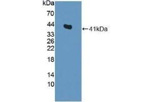 Detection of Recombinant CENTa2, Rat using Polyclonal Antibody to Centaurin Alpha 2 (CENTa2) (ADAP2 Antikörper  (AA 49-360))