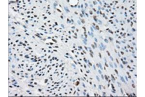 Image no. 2 for anti-Protein Phosphatase 5, Catalytic Subunit (PPP5C) antibody (ABIN1500389)