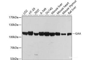 Western blot analysis of extracts of various cell lines using GAA Polyclonal Antibody at dilution of 1:1000. (GAA Antikörper)