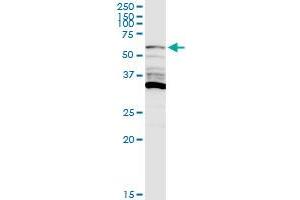 PIP5K1A MaxPab rabbit polyclonal antibody. (PIP5K1A Antikörper  (AA 1-500))