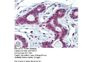Immunohistochemistry with Human Breast tissue at an antibody concentration of 5. (FUBP1 Antikörper  (Middle Region))