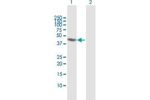 Western Blot analysis of RNF113B expression in transfected 293T cell line by RNF113B MaxPab polyclonal antibody. (RNF113B Antikörper  (AA 1-322))