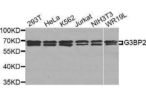 Western Blotting (WB) image for anti-GTPase Activating Protein (SH3 Domain) Binding Protein 2 (G3BP2) antibody (ABIN1877055) (G3BP2 Antikörper)
