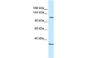 WB Suggested Anti-Zbtb38 Antibody   Titration: 1. (ZBTB38 Antikörper  (C-Term))