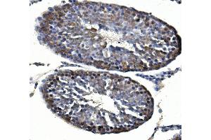 IHC analysis of Inhibin alpha/INHA using anti-Inhibin alpha/INHA antibody (ABIN7600932).