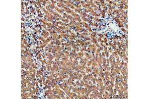 IHC analysis of ALDH1A3 using anti-ALDH1A3 antibody (ABIN5518802). (ALDH1A3 Antikörper  (AA 37-154))