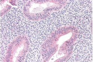 ABIN184636 (10µg/ml) staining of paraffin embedded Human Uterus. (MTM1 Antikörper  (C-Term))