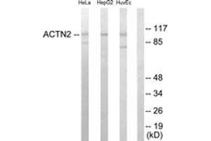 Western blot analysis of extracts from HepG2/HeLa/HuvEc cells, using Actinin alpha-2/3 Antibody. (ACTN2/3 Antikörper  (AA 31-80))