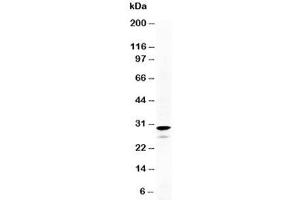 Western blot testing of Calretinin antibody and HeLa cell lysate. (Calretinin Antikörper  (N-Term))