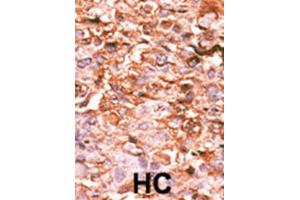 Immunohistochemistry (IHC) image for anti-HIST1H3B3 (pSer10) antibody (ABIN2933004) (HIST1H3B3 (pSer10) Antikörper)