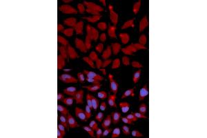 Immunofluorescence analysis of U2OS cells using DNMT3A antibody (ABIN5971096). (DNMT3A Antikörper)