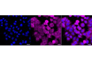 anti-Exocyst Complex Component 3 (EXOC3) antibody
