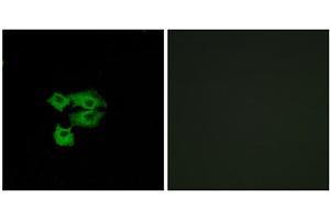 Immunofluorescence analysis of A549 cells, using LY6E antibody. (LY6E Antikörper  (Internal Region))
