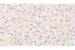 Detection of F2 in Human Liver Tissue using Monoclonal Antibody to Coagulation Factor II (F2) (Prothrombin Antikörper)