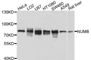 Western blot analysis of extracts of various cell lines, using NUMB antibody.