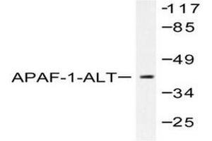 Image no. 2 for anti-Apoptotic Peptidase Activating Factor 1 (APAF1) antibody (ABIN265312) (APAF1 Antikörper)