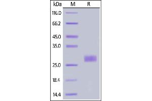 IL-33 Protein (AA 109-270) (His tag)