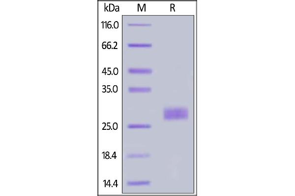 IL-33 Protein (AA 109-270) (His tag)