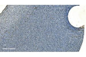 IHC analysis of H Cadherin/CDH13 using anti-H Cadherin/CDH13 antibody (ABIN7600095). (Cadherin 13 Antikörper  (AA 149-692))