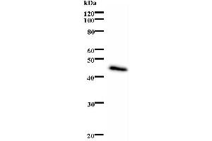 Western Blotting (WB) image for anti-Excision Repair Cross-Complementing Rodent Repair Deficiency, Complementation Group 6 (ERCC6) antibody (ABIN932472) (ERCC6 Antikörper)