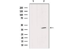 Western blot analysis of extracts from HepG2, using SFXN4 Antibody. (Sideroflexin 4 Antikörper  (N-Term))