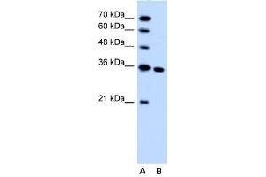 SLC25A29 antibody used at 1.
