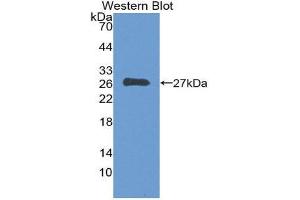 Western Blotting (WB) image for anti-Fms-Related tyrosine Kinase 3 (FLT3) (AA 334-543) antibody (ABIN3209637) (FLT3 Antikörper  (AA 334-543))