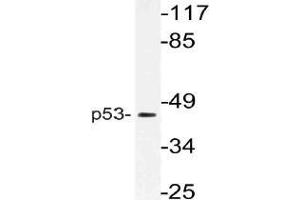 Western blot (WB) analysis of p53 antibody in extracts from 293 cells. (p53 Antikörper)