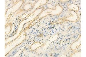 ABIN6257079 and ABIN6275722 at 1/100 staining human normal kidney tissue by IHC-P. (ANKRD20A1 Antikörper  (N-Term))