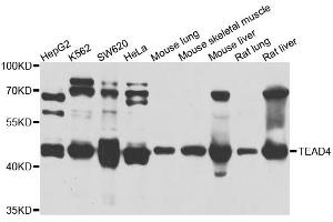 Western blot analysis of extracts of various cell lines, using TEAD4 antibody (ABIN5972288) at 1/1000 dilution. (TEAD4 Antikörper)