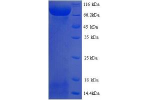 SDS-PAGE (SDS) image for Lysyl Oxidase-Like 2 (LOXL2) (AA 26-776) protein (His tag) (ABIN5713616) (LOXL2 Protein (AA 26-776) (His tag))