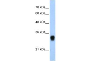 Western Blotting (WB) image for anti-Ribosomal Protein L8 (RPL8) antibody (ABIN2462054) (RPL8 Antikörper)