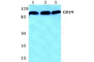 Western Blot analysis of CD19 antibody at 1/500 dilution: Lane 1: MCF-7 cell lysate. (CD19 Antikörper)