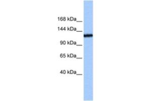 Western Blotting (WB) image for anti-Testis Expressed 2 (TEX2) antibody (ABIN2463273) (TEX2 Antikörper)