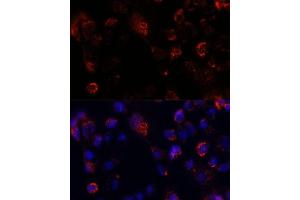Immunofluorescence analysis of  cells using  antibody (ABIN7265429) at dilution of 1:100. (ACOT9 Antikörper  (AA 22-250))