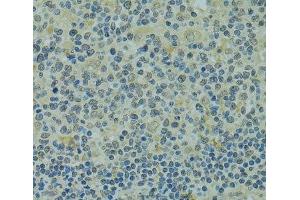 Immunohistochemistry of paraffin-embedded Human tonsil using IVNS1ABP Polyclonal Antibody at dilution of 1:100 (40x lens). (IVNS1ABP Antikörper)