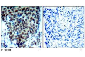 Image no. 2 for anti-Mitogen-Activated Protein Kinase 14 (MAPK14) (pThr180) antibody (ABIN197010) (MAPK14 Antikörper  (pThr180))
