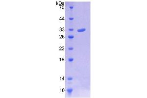SDS-PAGE analysis of Human TWINL Protein.